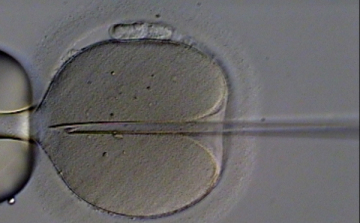 Értelmi fogyatékosságot okozhat az IVF? 