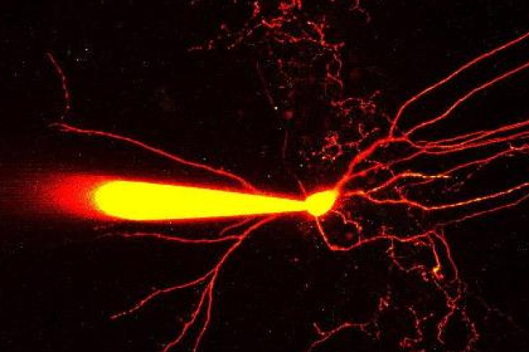 Magyar agykutatók a gátló idegsejtek egyedülálló vizsgálati módszerét dolgozták ki